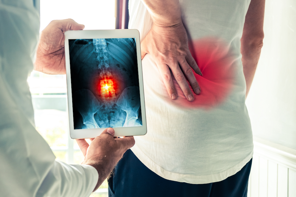 doctor showing spine xray result